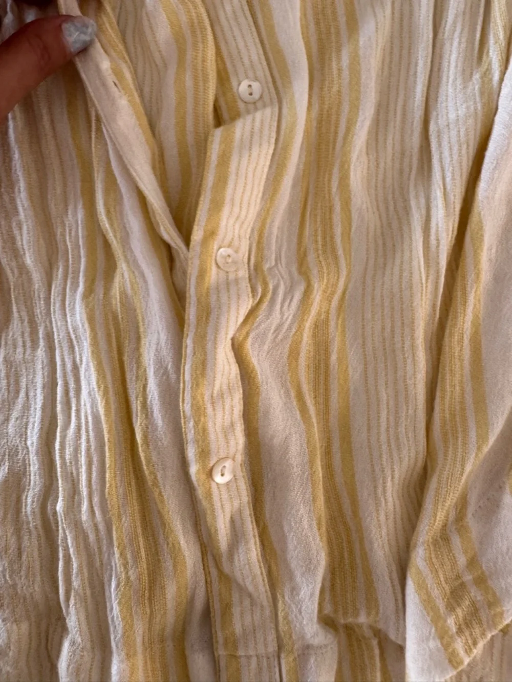 Free People Yellow and White Striped Button-Down Top